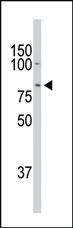 Anti-DCLK1 Rabbit Polyclonal Antibody