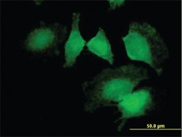 Anti-CNN2 Mouse Polyclonal Antibody