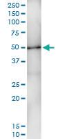 Anti-UCKL1 Rabbit Polyclonal Antibody