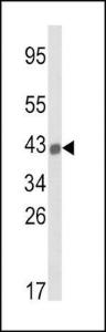 Anti-HLA Class 1 Antigen B Rabbit Polyclonal Antibody (HRP (Horseradish Peroxidase))