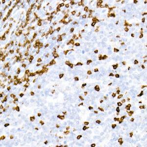 Immunohistochemistry analysis of paraffin-embedded human tonsil using Anti-CD3 epsilon Antibody [ARC51750] (A308227) at a dilution of 1:1,000 (40x lens). Perform high pressure antigen retrieval with 10 mM citrate buffer pH 6.0 before commencing with IHC staining protocol.