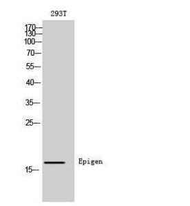 Western blot analysis of 293T cells using Anti-EPGN Antibody