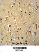 Anti-WDR73 Rabbit Polyclonal Antibody (HRP (Horseradish Peroxidase))