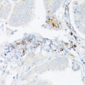 Anti-TNF alpha Rabbit Polyclonal Antibody