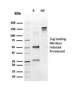 Anti-MSK1 antibody