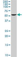 Anti-UCKL1 Rabbit Polyclonal Antibody