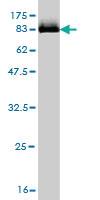 Anti-STK33 Mouse Monoclonal Antibody [clone: 1F10]