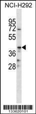 Anti-CD86 Rabbit Polyclonal Antibody (Biotin)