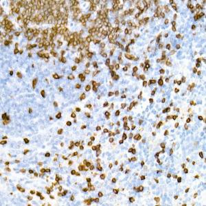 Immunohistochemistry analysis of paraffin-embedded mouse spleen using Anti-CD3 epsilon Antibody [ARC51750] (A308227) at a dilution of 1:1,000 (40x lens). Perform high pressure antigen retrieval with 10 mM citrate buffer pH 6.0 before commencing with IHC staining protocol.