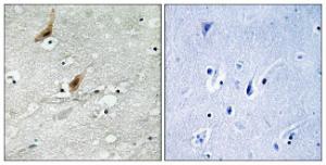 Antibody anti-MSK2 phospho THR568 100 µg