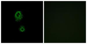 Immunofluorescence analysis of A549 cells using Anti-MRGRG Antibody. The right hand panel represents a negative control, where the antibody was pre-incubated with the immunising peptide.