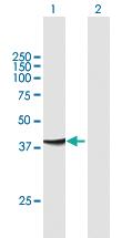 Anti-ADAP1 Mouse Polyclonal Antibody