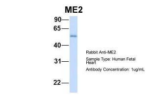 Anti-ME2 Rabbit Polyclonal Antibody