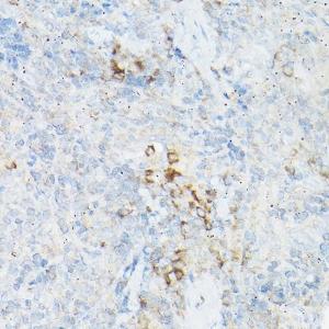 Anti-TNF alpha Rabbit Polyclonal Antibody