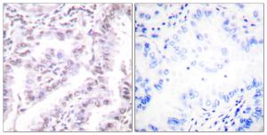 Anti-Ku80 Rabbit Polyclonal Antibody