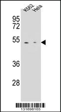 Anti-CPB1 Rabbit Polyclonal Antibody