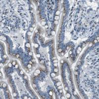 Anti-TXNDC15 Rabbit Polyclonal Antibody