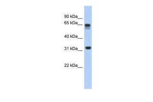 Anti-RPS3A Rabbit Polyclonal Antibody