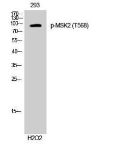 Antibody anti-MSK2 phospho THR568 100 µg