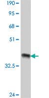 Anti-ROBO1 Mouse Polyclonal Antibody