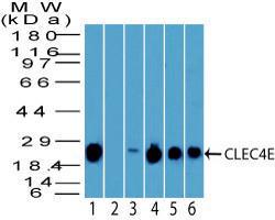 Anti-CLEC4E Rabbit Polyclonal Antibody