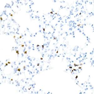 Immunohistochemistry analysis of paraffin-embedded rat lung using Anti-CD3 epsilon Antibody [ARC51750] (A308227) at a dilution of 1:1,000 (40x lens). Perform high pressure antigen retrieval with 10 mM citrate buffer pH 6.0 before commencing with IHC staining protocol.