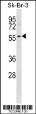 Anti-STK17A Rabbit Polyclonal Antibody