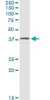 Anti-CNN3 Mouse Monoclonal Antibody [clone: 2C7]