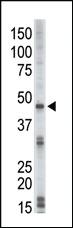 Anti-STK17B Rabbit Polyclonal Antibody