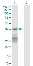 Anti-CNN3 Mouse Monoclonal Antibody [clone: 2C7]