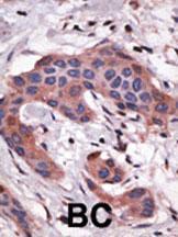 Anti-BID Rabbit Polyclonal Antibody (FITC (Fluorescein Isothiocyanate))