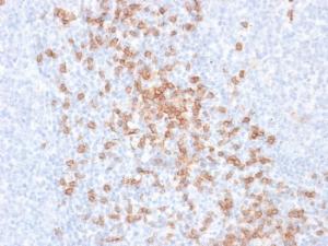 Anti-CD8A Mouse Recombinant Antibody [clone: rC8/468]