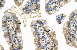 Anti-MCM8 Rabbit Polyclonal Antibody