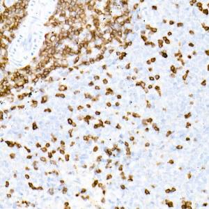 Immunohistochemistry analysis of paraffin-embedded rat spleen using Anti-CD3 epsilon Antibody [ARC51750] (A308227) at a dilution of 1:1,000 (40x lens). Perform high pressure antigen retrieval with 10 mM citrate buffer pH 6.0 before commencing with IHC staining protocol.