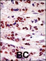 Anti-STK17B Rabbit Polyclonal Antibody