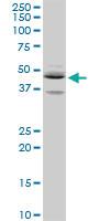 Anti-SEPT5 Rabbit Polyclonal Antibody