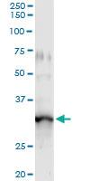 Anti-GIMAP5 Antibody Pair