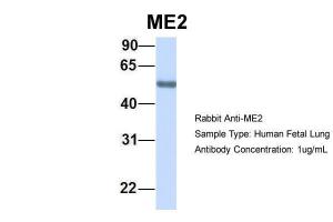 Anti-ME2 Rabbit Polyclonal Antibody