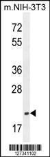 Anti-TCAL3 Rabbit Polyclonal Antibody