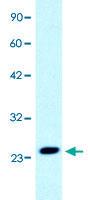 Anti-C1orf149 Rabbit Polyclonal Antibody