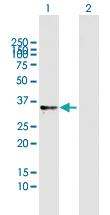 Anti-RNASET2 Mouse Polyclonal Antibody