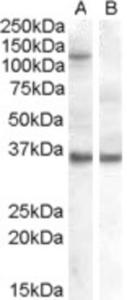 HEK293 overexpressing EIF2C1 and probed with EB07129 (non-transfected HEK293 in lane B).