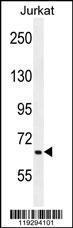 Anti-F11 Rabbit Polyclonal Antibody (PE (Phycoerythrin))