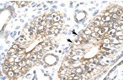 Anti-C1orf149 Rabbit Polyclonal Antibody