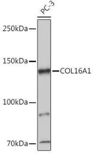 Western blot analysis of extracts of PC-3 cells, using Anti-COL16A1 Antibody (A308228) at 1:1,000 dilution. The secondary antibody was Goat Anti-Rabbit IgG H&L Antibody (HRP) at 1:10,000 dilution.