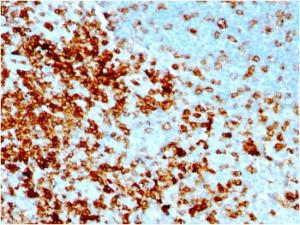 Immunohistochemical analysis of formalin-fixed, paraffin-embedded human tonsil using Anti-CD43 Antibody [rSPN/1094]