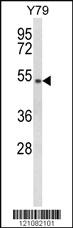 Anti-GTF2H4 Rabbit Polyclonal Antibody