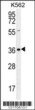 Anti-SLC25A31 Rabbit Polyclonal Antibody