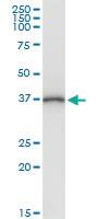 Anti-PANK1 Polyclonal Antibody Pair