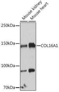 Western blot analysis of extracts of various cell lines, using Anti-COL16A1 Antibody (A308228) at 1:1,000 dilution. The secondary antibody was Goat Anti-Rabbit IgG H&L Antibody (HRP) at 1:10,000 dilution.